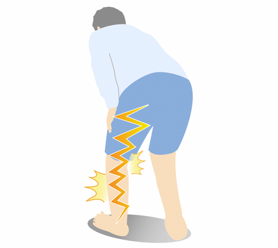 Is There a Cure for Sciatica?